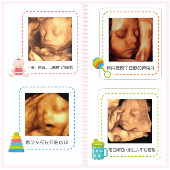 基础超声检查和胎儿四维成像